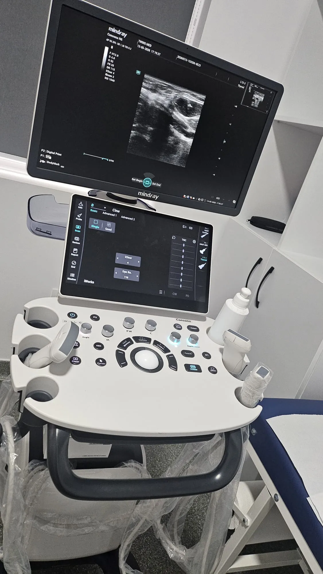 Ecograful modern, de ultimă generație, folosit la consultațiile de urologie TwinsMed